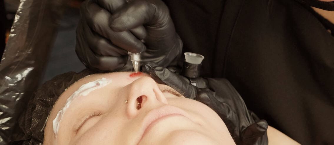 Brownude-Edmonton-Scalp