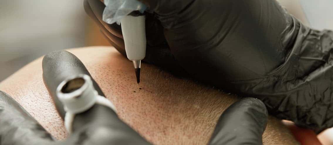 Scalp-Micropigmentation-Cosmetic-Tattoo-Permanent-Makeup