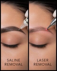 Eyebrow treatment before and after saline and laser removal techniques.
