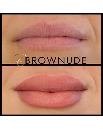 Close-up of lips showing before and after lip enhancement with Brownude.