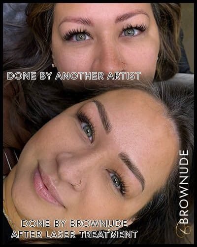 Close-up of eyebrows after laser correction by Brownude artist.